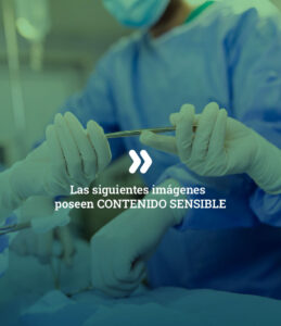enfermedad-peyronie-contenido-sensible